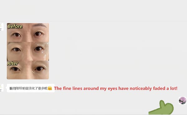 Balancing and Hydrating Eye Patches